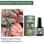 Nail Treatment Supplier - High Quality 15ml Nail Fungus Treatment Nail Health Care