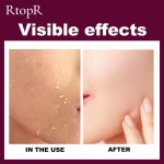 Face Scrub Manufacturer - RtopR Whitening Moisturizer Facial Scrub Acne Treatment