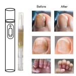 Nail Repair Pen Supplier - Hot Sale Nail Repair Pen Cuticle Oil Manicure Tools