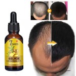 Hair Growth Oil Supplier - OEM ODM Hair Loss Treatment Oil Natural Regrow 7 Days