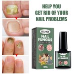 Nail Treatment Supplier - High Quality 15ml Nail Fungus Treatment Nail Health Care