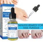 Nail Care Serum Supplier - Tonisabery Moisturizing Soft Nail Care Nail Repair Serum