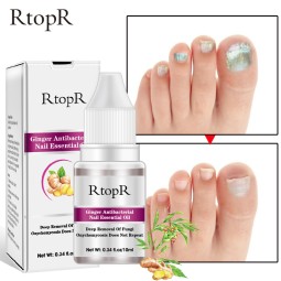 Nail Treatment Supplier - Wholesale Natural Herbal Fast Strong Effect Onychomycosis