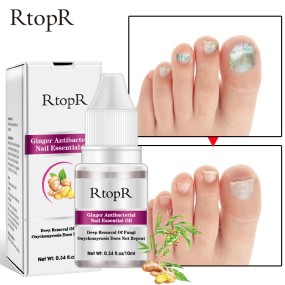 Nail Treatment Supplier - Wholesale Natural Herbal Fast Strong Effect Onychomycosis