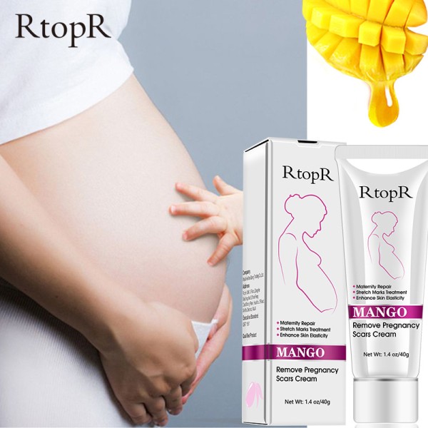 Stretch Mark Cream Manufacturer - Mango Stretch Mark Cream Pregnancy Repair Scar