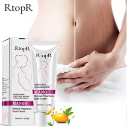 Maternity Cream Factory - Rtopr Maternity Stretch Marks Remover Cream Postpartum