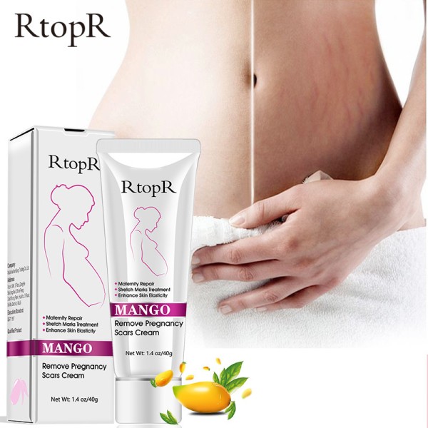 Maternity Cream Factory - Rtopr Maternity Stretch Marks Remover Cream Postpartum