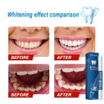 Teeth Whitening Pen Factory - New Product Teeth Whitening Pen Oral Hygiene Stains Remover
