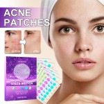 Colorful Acne Patch Manufacturer - 180PCS Colorful Pimple Patch Salicylic Acid Tea Tree Oil