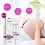 Stretch Marks Cream Supplier - 50% Discount US Popular Mango Remove Pregnancy Skin Care