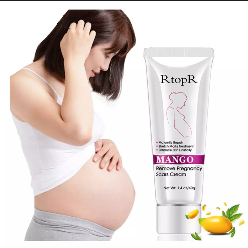 Stretch Marks Cream Supplier - 50% Discount US Popular Mango Remove Pregnancy Skin Care