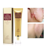 Scar Removal Cream Supplier - Scar Remove Gels Professional Effective Cream Relief Acne Mark