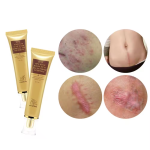 Scar Removal Cream Supplier - Scar Remove Gels Professional Effective Cream Relief Acne Mark