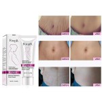 Stretch Marks Cream Supplier - 50% Discount US Popular Mango Remove Pregnancy Skin Care