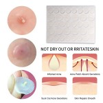 Hydrocolloid Patch Supplier - Mighty Holographic Star Heart