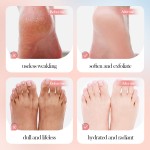 Foot Peel Mask Factory - Rose Exfoliating Heel Renewal