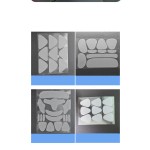 Nail Repair Patch Supplier - Foot Care Gel Material Antibacterial