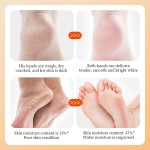 Foot Leg Mask Supplier - High Quality Natural Moisturizing Spa