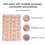 Hydrocolloid Acne Patch Manufacturer - Mighty Custom Private Label