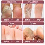 Foot Mask Socks Manufacturer - Effective Dead Skin Exfoliating