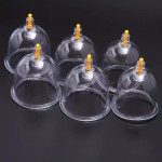 Vacuum Cupping Set Supplier - Good Quality OEM Cupping Cups for Hijama Therapy Pain Relief