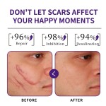 Scar Removal Cream Supplier - Professional Medical Grade Scar Removal Cream Natural Herbal Formula