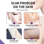 Scar Removal Cream Supplier - Professional Medical Grade Scar Removal Cream Natural Herbal Formula