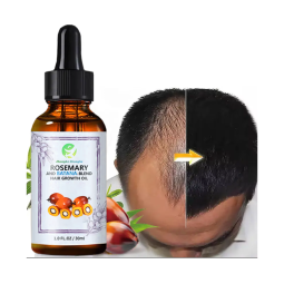 Hair Care Oil Supplier - Private Label Natural Organic Hair Growth Oil Scalp Care Loss Batana Smoothing
