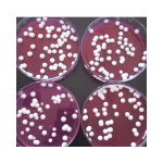 Paecilomyces Lilacinus Targeted  Root Knot Nematodes Fungi Treatment
