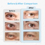 Eye Pad Supplier - Custom Reusable Cold Compress Ice Pack Gel Eye Pad for Beauty