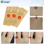 Corn Verruca Plaster Manufacturer - OEM Safely Remove