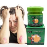 Psoriasis Cream Manufacturer - ZB Herbal Medicine Anti-Itch Antibacterial