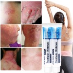 Eczema Ointment Factory - Chinese Herbal Antifungal Itching Peeling