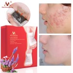 Foot Patch Supplier - 10pcs Lavender Nourishing Repair Soothing