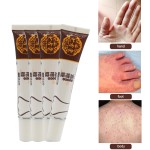 Nose Mides Cream Manufacturer - Herbal Rosacea Blackhead Remover Ointment