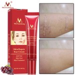 Scar Cream Manufacturer - 15g Skin Repair Cell Growth Elasticity