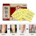 Varicose Vein Patch Manufacturer - Chinese Herb Phlebitis Care Plaster