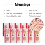 Foot Corns Cream Supplier - Removing Corns Calluses Pedicure Patch