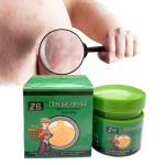 Psoriasis Cream Supplier - 20g ZB Eczema Dermatitis Bacteriostatic