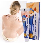 Warts Remover Manufacturer - Blue Ointment Flat Plantar Warts Treatment