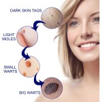 Warts Remover Supplier - 20g ZB Moles Wart Genital Skin Nursing