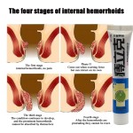 Hemorrhoids Ointment Supplier - 20g Internal External Mixed Anal Care
