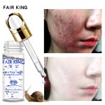 Snail Essence Liquid Supplier - Natural Pure Whitening Rejuvenating Care