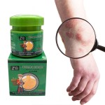 Psoriasis Cream Manufacturer - ZB Herbal Medicine Anti-Itch Antibacterial