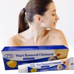 Warts Remover Manufacturer - Blue Ointment Flat Plantar Warts Treatment