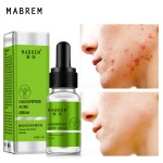 Acne Cleanser Serum Manufacturer - Oligopeptide Pore Repair Anti-Aging