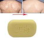 Sulfur Soap Manufacturer - Shanghai Brand Oil Control Acne Remover 85g