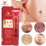 Scar Cream Manufacturer - 15g Skin Repair Cell Growth Elasticity