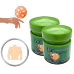 Psoriasis Cream Manufacturer - ZB Herbal Medicine Anti-Itch Antibacterial