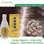Psoriasis Shampoo Supplier - Sulfur Compound Herbal Dermatitis Care
